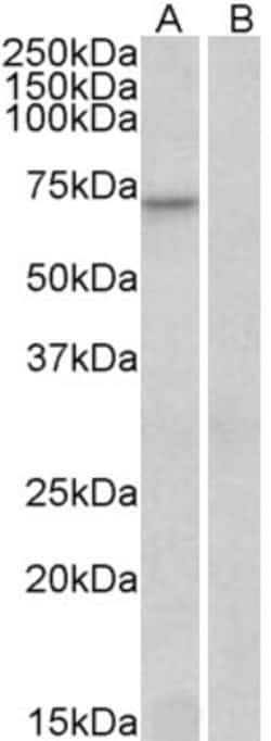 Invitrogen FOXO3A Polyclonal Antibody 100 &mu;g; Unconjugated:Antibodies,