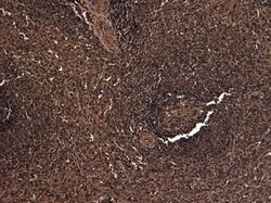 Invitrogen FOXP3 Polyclonal Antibody 100 &mu;g; Unconjugated:Antibodies,