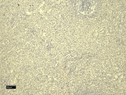 Invitrogen FOXP3 Polyclonal Antibody 100 &mu;g; Unconjugated:Antibodies,