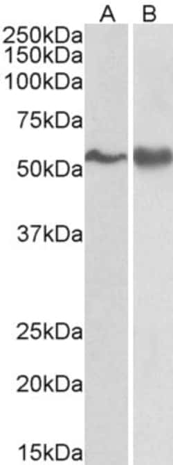 Fyn Polyclonal Antibody:Antibodies, Polyclonal