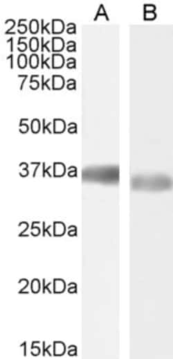 Invitrogen GAPDH Polyclonal Antibody 100 &mu;g; Unconjugated:Antibodies,