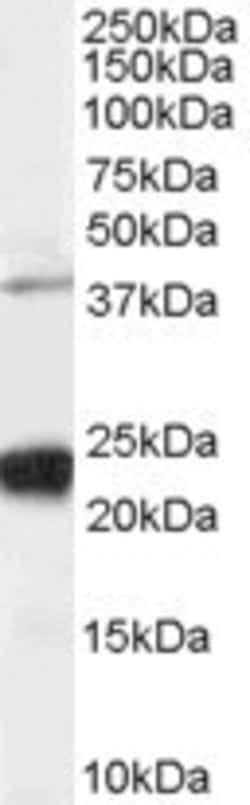Invitrogen GIPC1 Polyclonal Antibody 100 &mu;g; Unconjugated:Antibodies,