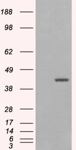 Invitrogen GIPC1 Polyclonal Antibody 100 &mu;g; Unconjugated:Antibodies,
