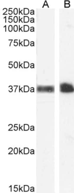Invitrogen CD235a Polyclonal Antibody 100 &mu;g; Unconjugated:Antibodies,