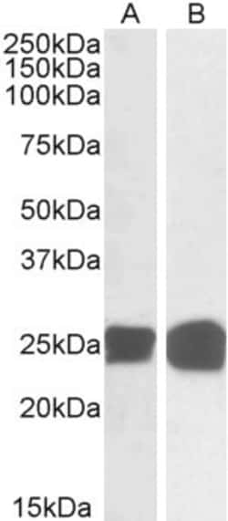 Invitrogen GRB2 Polyclonal Antibody 100 &mu;g; Unconjugated:Antibodies,