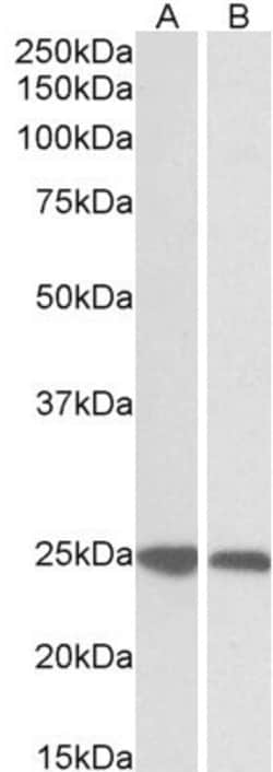 Invitrogen GRB2 Polyclonal Antibody 100 &mu;g; Unconjugated:Antibodies,
