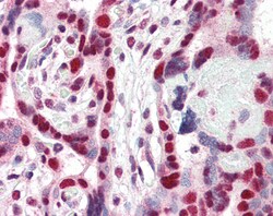 Invitrogen HP1 gamma Polyclonal Antibody 100 &mu;g; Unconjugated:Antibodies,