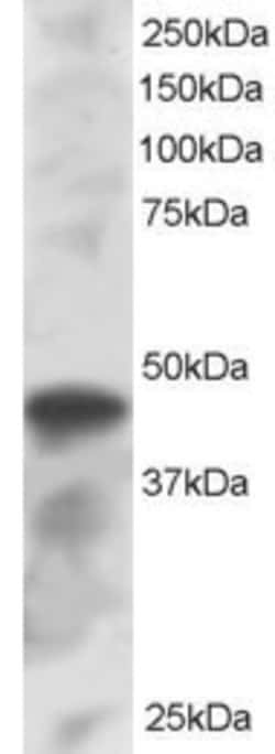 Invitrogen IRF8 Polyclonal Antibody 100 &mu;g; Unconjugated:Antibodies,