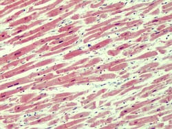 Invitrogen IRAK4 Polyclonal Antibody 100 &mu;g; Unconjugated:Antibodies,