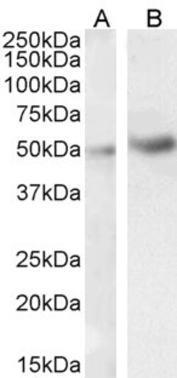Invitrogen IRAK4 Polyclonal Antibody 100 &mu;g; Unconjugated:Antibodies,