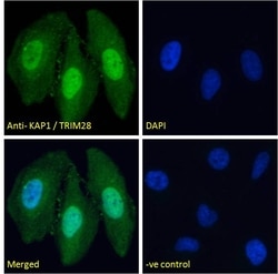 Invitrogen TRIM28 Polyclonal Antibody 100 &mu;g; Unconjugated:Antibodies,