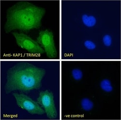 Invitrogen TRIM28 Polyclonal Antibody 100 &mu;g; Unconjugated:Antibodies,