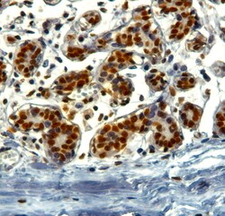 Invitrogen TRIM28 Polyclonal Antibody 100 &mu;g; Unconjugated:Antibodies,