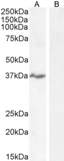 Invitrogen NKG2D Polyclonal Antibody 100 &mu;g; Unconjugated:Antibodies,