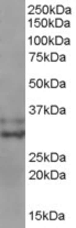 Invitrogen Livin Polyclonal Antibody 100 &mu;g; Unconjugated:Antibodies,