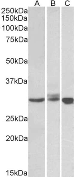 Invitrogen Livin Polyclonal Antibody 100 &mu;g; Unconjugated:Antibodies,