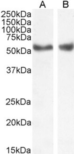 LXR alpha/beta Polyclonal Antibody:Antibodies, Polyclonal
