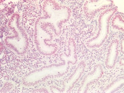 Invitrogen MAX Polyclonal Antibody 100 &mu;g; Unconjugated:Antibodies,