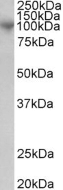 Invitrogen ADAM8 Polyclonal Antibody 100 &mu;g; Unconjugated:Antibodies,