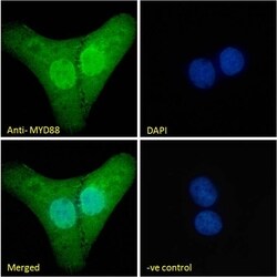 Invitrogen MyD88 Polyclonal Antibody 100 &mu;g; Unconjugated:Antibodies,