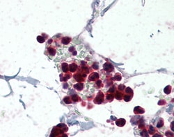 Invitrogen p47phox Polyclonal Antibody 100 &mu;g; Unconjugated:Antibodies,