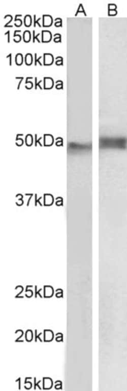 Invitrogen p47phox Polyclonal Antibody 100 &mu;g; Unconjugated:Antibodies,