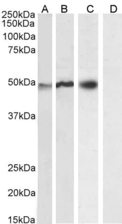 Invitrogen p47phox Polyclonal Antibody 100 &mu;g; Unconjugated:Antibodies,