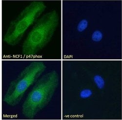 Invitrogen p47phox Polyclonal Antibody 100 &mu;g; Unconjugated:Antibodies,