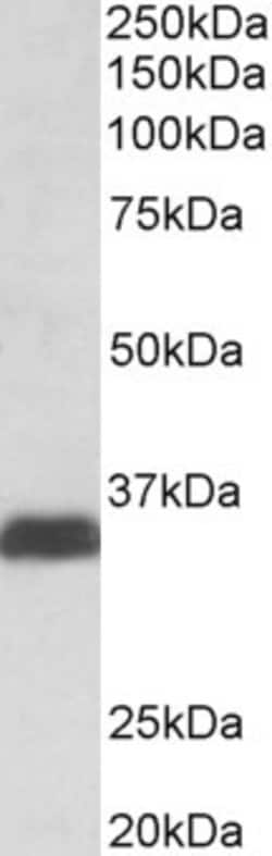 Invitrogen Osteopontin Polyclonal Antibody 100 &mu;g; Unconjugated:Antibodies,