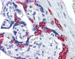 PAI1 Polyclonal Antibody:Antibodies, Polyclonal