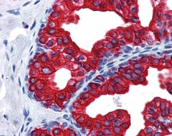 PAI1 Polyclonal Antibody:Antibodies, Polyclonal