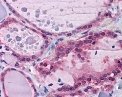 Invitrogen PPP2R1A Polyclonal Antibody 100 &mu;g | Buy Online | Invitrogen&trade; | Fisher Scientific