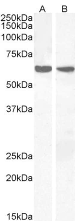 Invitrogen PPP2R1A Polyclonal Antibody 100 &mu;g | Buy Online | Invitrogen&trade; | Fisher Scientific