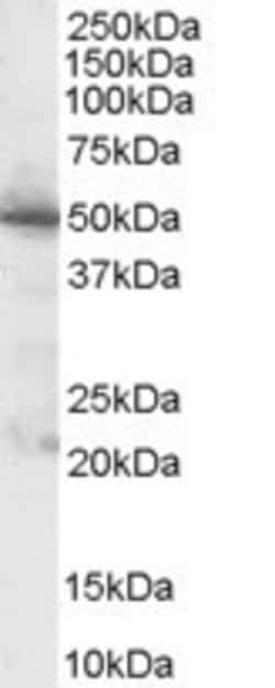 Invitrogen PDHX Polyclonal Antibody 100 &mu;g; Unconjugated:Antibodies,