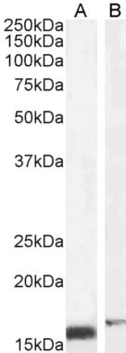 Invitrogen RBP1 Polyclonal Antibody 100 &mu;g; Unconjugated:Antibodies,