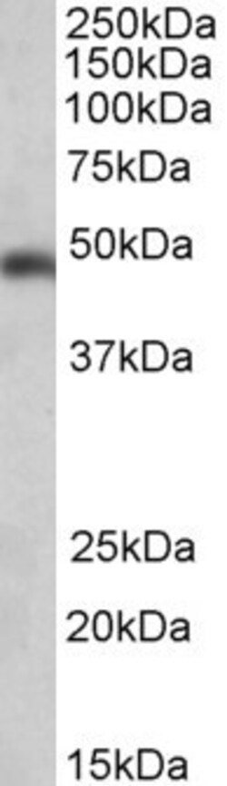 Invitrogen SEC61A1 Polyclonal Antibody 100 &mu;g | Buy Online | Invitrogen&trade; | Fisher Scientific