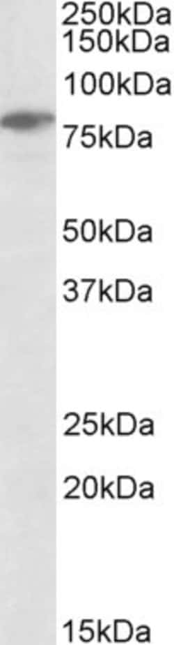 Invitrogen SLP76 Polyclonal Antibody 100 &mu;g; Unconjugated:Antibodies,