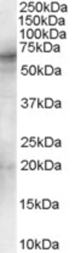 Invitrogen Syk Polyclonal Antibody 100 &mu;g; Unconjugated:Antibodies,