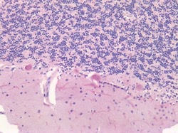 Invitrogen Survivin Polyclonal Antibody 100 &mu;g; Unconjugated:Antibodies,