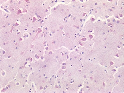 Invitrogen Survivin Polyclonal Antibody 100 &mu;g; Unconjugated:Antibodies,