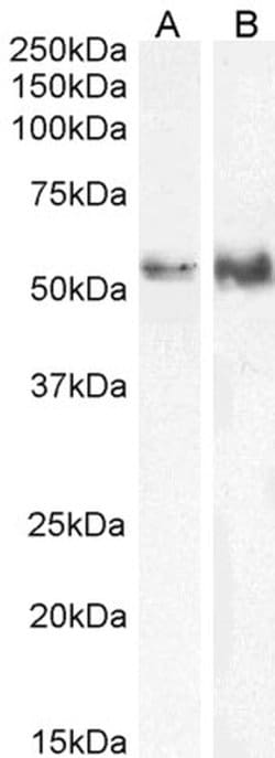 TFEB Polyclonal Antibody, Invitrogen 100 &mu;g | Buy Online | Thermo Scientific | Fisher Scientific