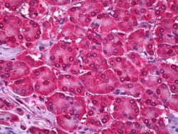 Invitrogen UBC9 Polyclonal Antibody 100 &mu;g; Unconjugated:Antibodies,