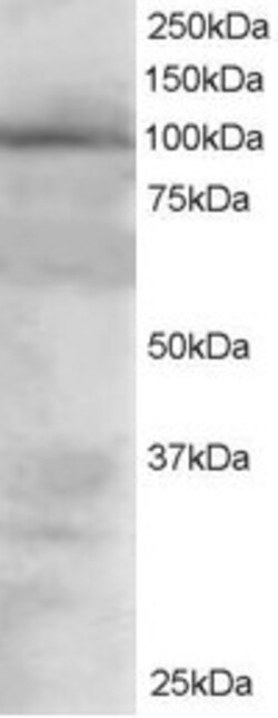 Invitrogen VAV2 Polyclonal Antibody 100 &mu;g; Unconjugated:Antibodies,