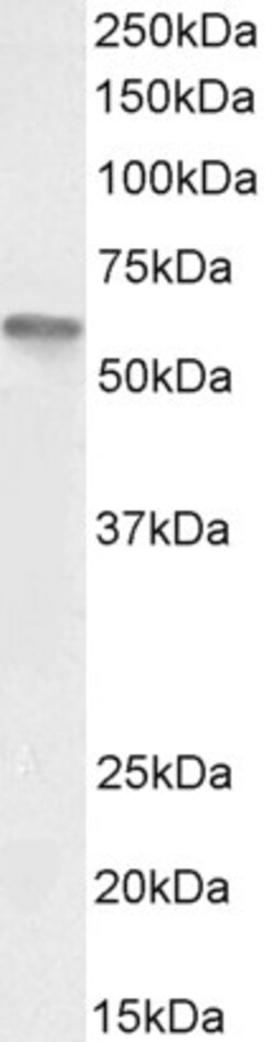 Invitrogen VDR Polyclonal Antibody 100 &mu;g; Unconjugated:Antibodies,