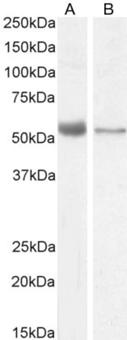 Invitrogen VDR Polyclonal Antibody 100 &mu;g; Unconjugated:Antibodies,