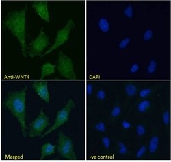 Invitrogen WNT4 Polyclonal Antibody 100 &mu;g; Unconjugated:Antibodies,