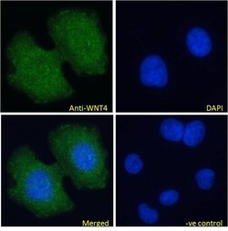 Invitrogen WNT4 Polyclonal Antibody 100 &mu;g; Unconjugated:Antibodies,