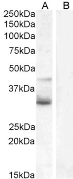 Invitrogen WNT4 Polyclonal Antibody 100 &mu;g; Unconjugated:Antibodies,