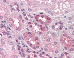 Invitrogen PCSK6 Polyclonal Antibody 100 &mu;g; Unconjugated:Antibodies,