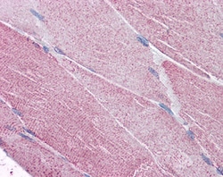 Invitrogen PCSK6 Polyclonal Antibody 100 &mu;g; Unconjugated:Antibodies,